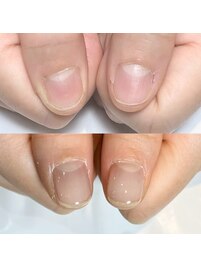 自爪を強く健康的に育む自爪育成