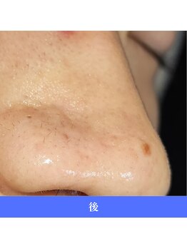 レイ(R.E.I)/一発OK！