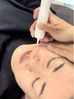 ビュースタイル 梅田 茶屋町店の写真/気になるシミに徹底アプローチ！最新機器を使っての施術☆シミケアだけでなく肌質改善で美肌＆小顔効果も◎
