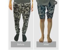 アンドゥ(undo)/美姿勢美脚コース