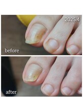 爪切り屋 足楽/