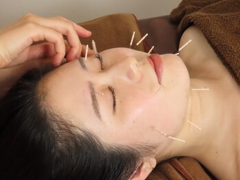 ジネコラボ 新橋汐留店(Gyneco-labo)/美容鍼灸(美顔鍼)