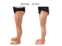 ヨサパーク サノン(YOSA PARK Sanon)/１回でもこの効果！