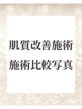 ドレス(dress)/肌質改善施術比較写真