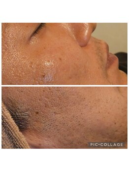 ミホズルーム(Miho‘s room)/凹凸のある肌には