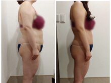 アイディエム 新宿店(IDM)/【モニター】162ｃｍ・30代