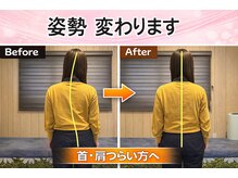カイロプラクティック金子施術院/before &nbsp;after
