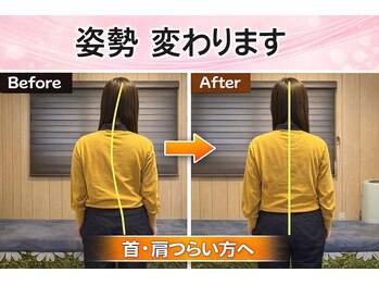 カイロプラクティック金子施術院/before &nbsp;after
