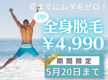 ユー(U)