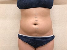 カブール 姫路店/2.写真・測定☆