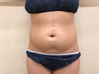 カブール 姫路店/2.写真・測定☆