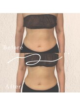 ブリリアントライフ(Blilyant life)/美しいくびれ作り