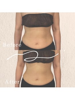 ブリリアントライフ(Blilyant life)/美しいくびれ作り