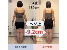ナチュールフィット(Natur Fit)/64歳　ビフォーアフター