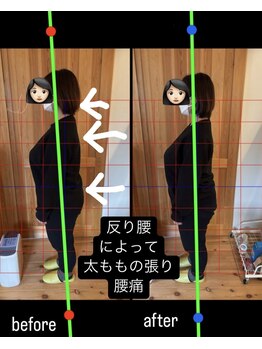 はまもと整骨院/整体・姿勢改善