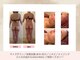 ビューティーマックス(Beauty Max)の写真