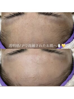 ブラン ネージュ(Blanc Neige)/フェイシャルワックス