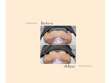 オベリオ(OBERIO)/