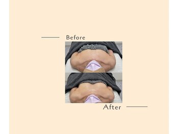 オベリオ(OBERIO)/