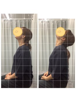 大阪心斎橋整体院/整体で首・肩こり改善♪