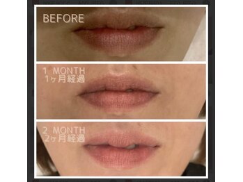 ファースト(1st)/ローマピンク【唇・リップ】