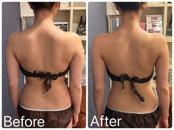 サロンドフェイス(Salon de Faith)/ブライダル10回