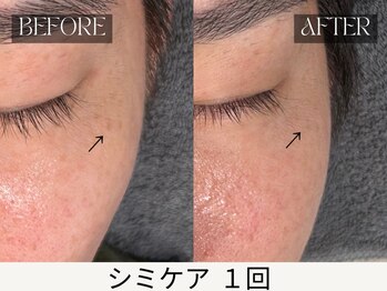 スキンジム(SKIN GYM)/鏡を見るたび嬉しくなる素肌へ