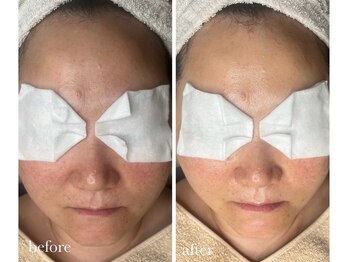 サロン ド ラム/［PDTコース］初回