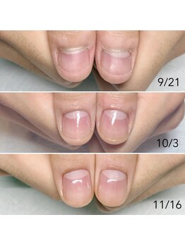 爪の悩みを解消できる（ケア含む）