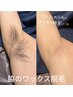 【1発で綺麗に！】肌の色もトーンアップ◎ &nbsp;脇のワックス脱毛　¥2,800