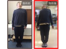 まこと整骨院/30年越しの腰痛整体　２
