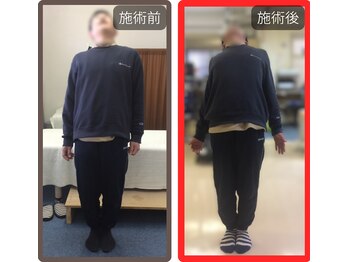 まこと整骨院/30年越しの腰痛整体　２