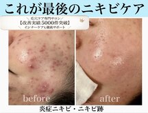 エミナル(eminal)