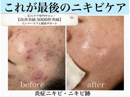 エミナル(eminal)の写真