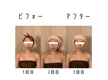 比較写真フォトギャラリーに比較写真多数掲載中！