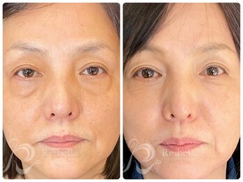 ビースキン 藤沢店(BeSkin)/リベルハーブは幅広い年齢層に◎