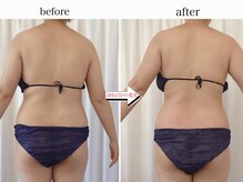 トレゾール(tresor)/★痩身★赤坂痩身エステ