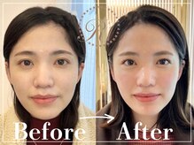 R-1ビューティーサロン 表参道/Before＆After