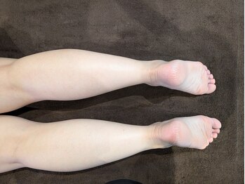 美々庵/LED脱毛＊足