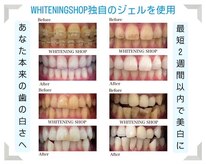 ホワイトニングショップ 大阪玉造店