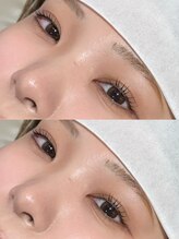 初めての方にもご不安がないよう、施術前にしっかりとカウンセリングのお時間を設けております♪