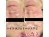 【期間限定】紫外線ダメージ回復！ハイドロジェリーマスク　6,980円→4,500円