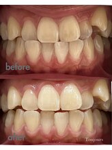 トゥジュール(Toujours)/美容ジェル１回