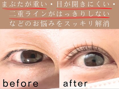 マーブル(marble)の写真