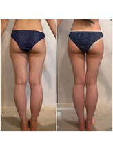 骨盤ストレッチ整体 b/O脚のお悩みもお任せください♪