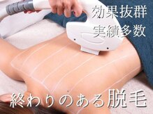 フェアリー 小松店の雰囲気（産毛・チクチク毛にもしっかりアタック！圧倒的終わりのある脱毛）