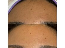 ベルアイラッシュ(Belleyelash)/【フェイシャルワックス】