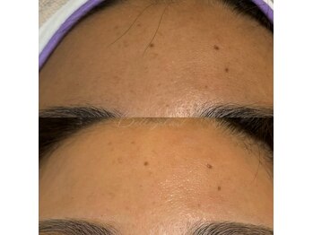 ベルアイラッシュ(Belleyelash)/【フェイシャルワックス】