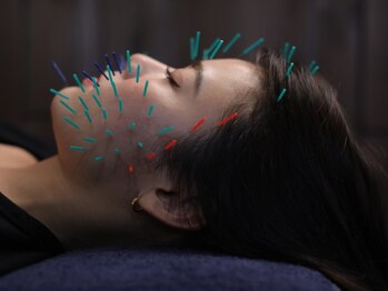 ネオオアシストウキョウ(ネオ OASIS TOKYO)の写真/【お客様の状態に合わせた施術】皮膚・筋肉・細胞・神経へアプローチするサボテン美容鍼♪