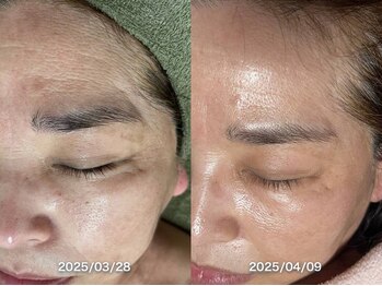 サロンドジェシカ(salon de Jessica)/プラズマ